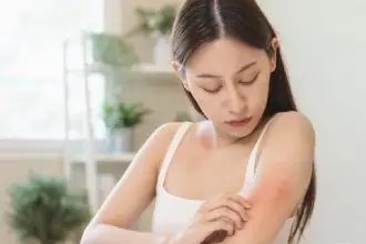 Caterpillar rash can cause dermatitis. Please know how to deal with it