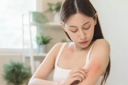 Caterpillar rash can cause dermatitis. Please know how to deal with it