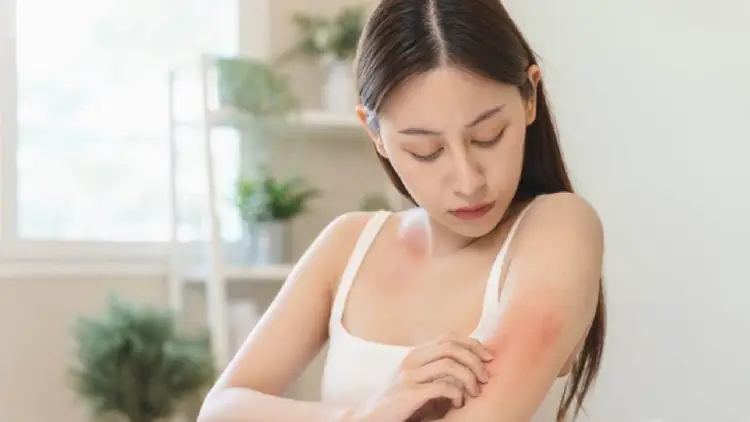 Caterpillar rash can cause dermatitis. Please know how to deal with it