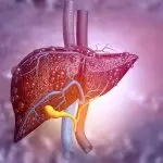 Fatty liver disease, a complication of diabetes, deserves further attention