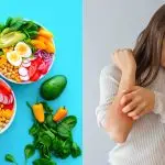 healthy diet for psoriasis