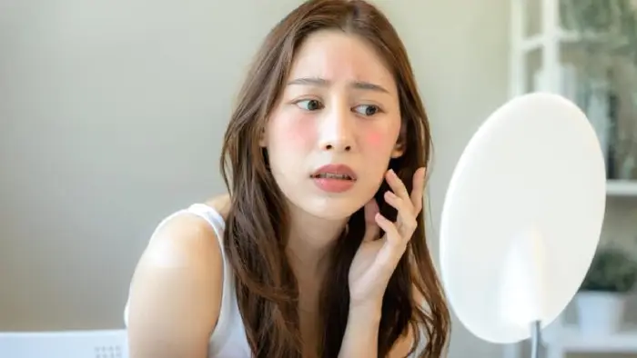 Acne to sunburn to sunburn: 11 causes of redness in the skin