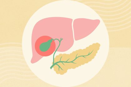 What Is Acalculous Cholecystitis?