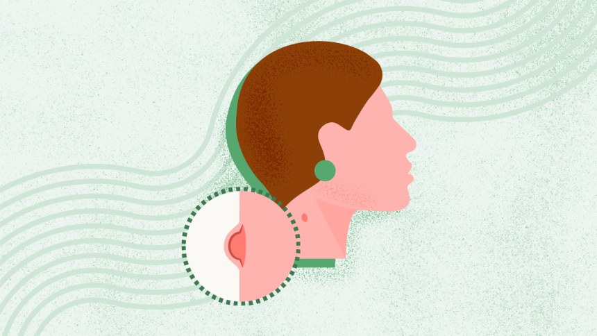 What Is Acne?