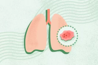 What Is Lung Cancer?