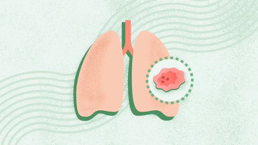 What Is Lung Cancer?