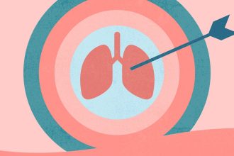 8 Things to Know About Targeted Therapies for Metastatic Non-Small Cell Lung Cancer