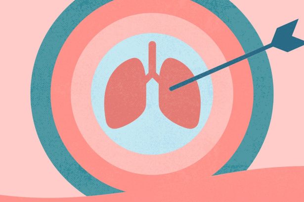8 Things to Know About Targeted Therapies for Metastatic Non-Small Cell Lung Cancer