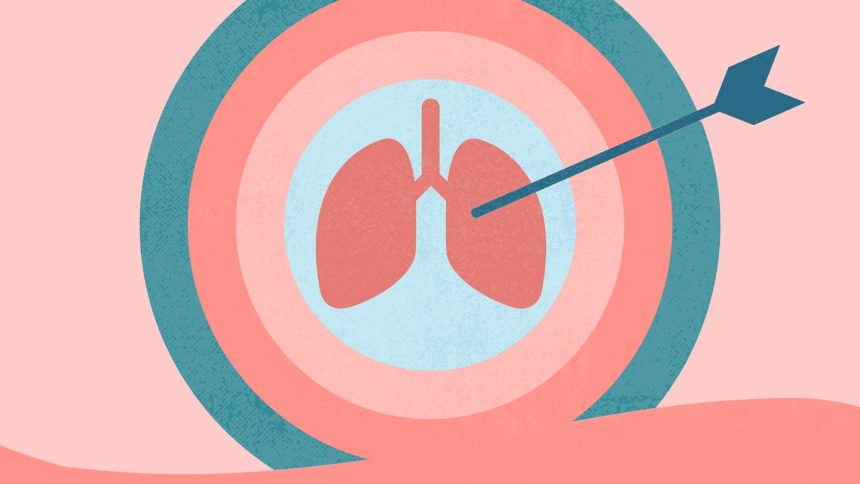 8 Things to Know About Targeted Therapies for Metastatic Non-Small Cell Lung Cancer
