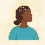 What Is Alopecia Areata? Symptoms, Causes, Diagnosis, and Treatment