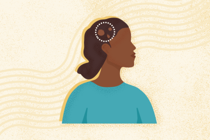 What Is Alopecia Areata? Symptoms, Causes, Diagnosis, and Treatment