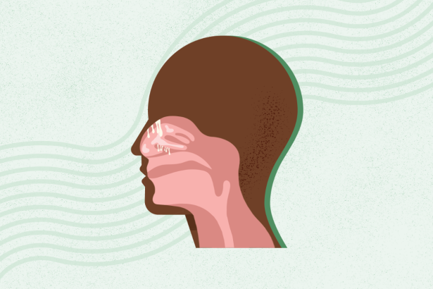 What Are Nasal Polyps? Symptoms, Causes, Diagnosis, Treatment, and Prevention