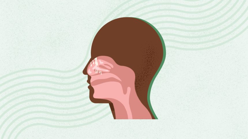 What Are Nasal Polyps? Symptoms, Causes, Diagnosis, Treatment, and Prevention