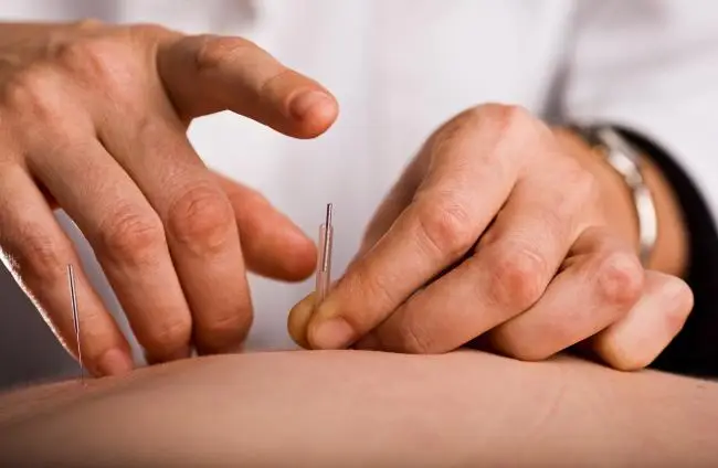 Acupuncture improves the effects of chronic low back pain in elderly people