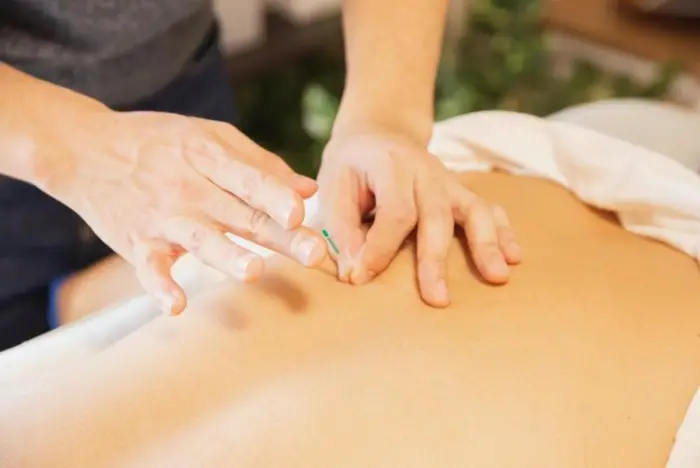 Acupuncture treatment considered effective for chronic lower back pain in elderly people