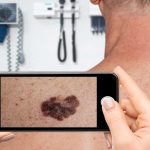 Is your skin app misleading you? Why is it necessary to see a dermatologist?