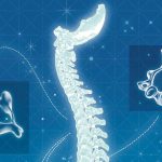 Spine surgery that doesn't need to occur