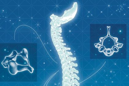 Spine surgery that doesn't need to occur