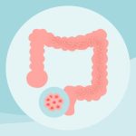 8 Myths About Colon Cancer Debunked