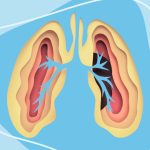 7 Myths About Lung Cancer